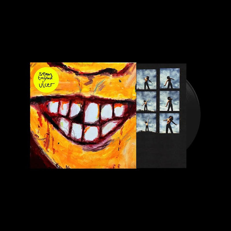 Sean Trelford - ulcer *Pre-Order