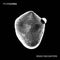 Propaganda - Remix Encounters *Pre-Order